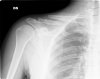 clavicola.1.jpg