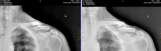 clavicola 09 2024.png